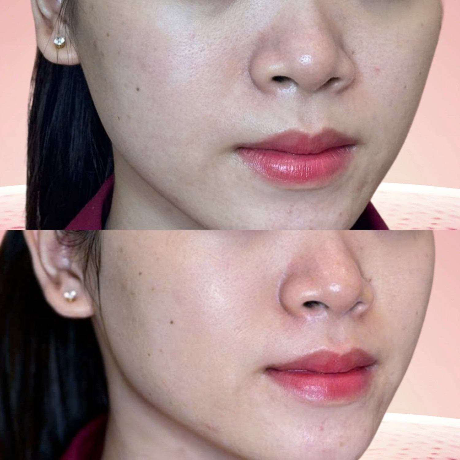 Hiệu ứng trẻ hóa tự nhiên, không làm thay đổi đường nét vốn có của khuôn mặt