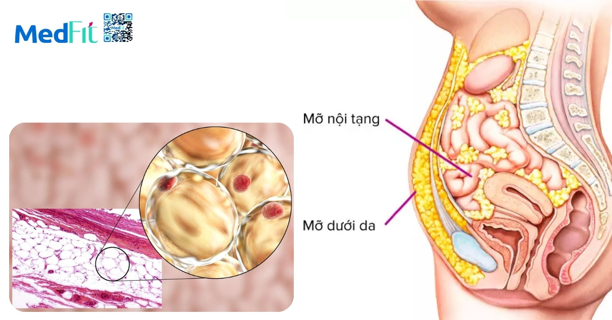 Mối liên hệ giữa béo phì và lão hoá: Hiểu đúng để sống khỏe và trẻ lâu hơn 1 béo phì