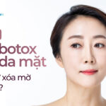 Sự thật về tiêm botox căng da mặt: Có thật sự xóa mờ nếp nhăn?