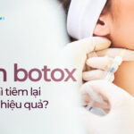 Tiêm botox bao lâu thì tiêm lại để duy trì hiệu quả?