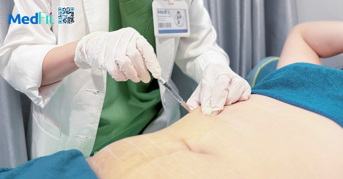 Đeo đai nịt bụng có giảm mỡ bụng không? Làm sao để giảm mỡ bụng hiệu quả? 18 Đeo đai nịt bụng có giảm mỡ bụng không? Làm sao để giảm mỡ bụng hiệu quả? 17