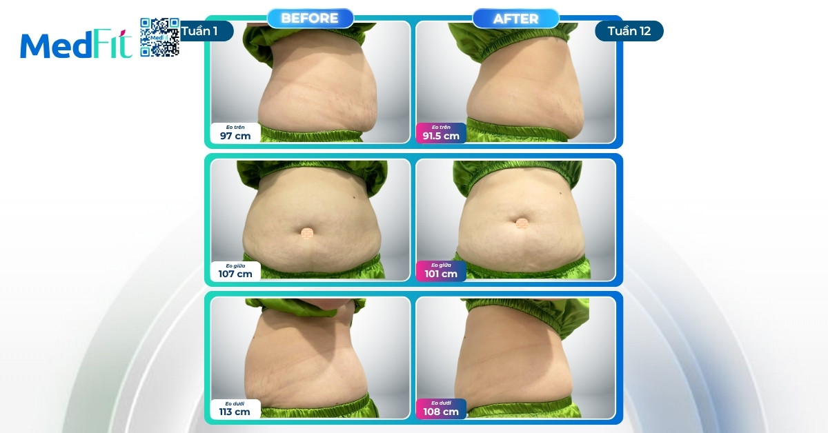 12 tuần chỉ với liệu trình dinh dưỡng vận động tại MedFit, khách hàng giảm gần 6kg và 16,5cm vòng eo 7 12 tuần chỉ với liệu trình dinh dưỡng vận động tại MedFit, khách hàng giảm gần 6kg và 16,5cm vòng eo 6