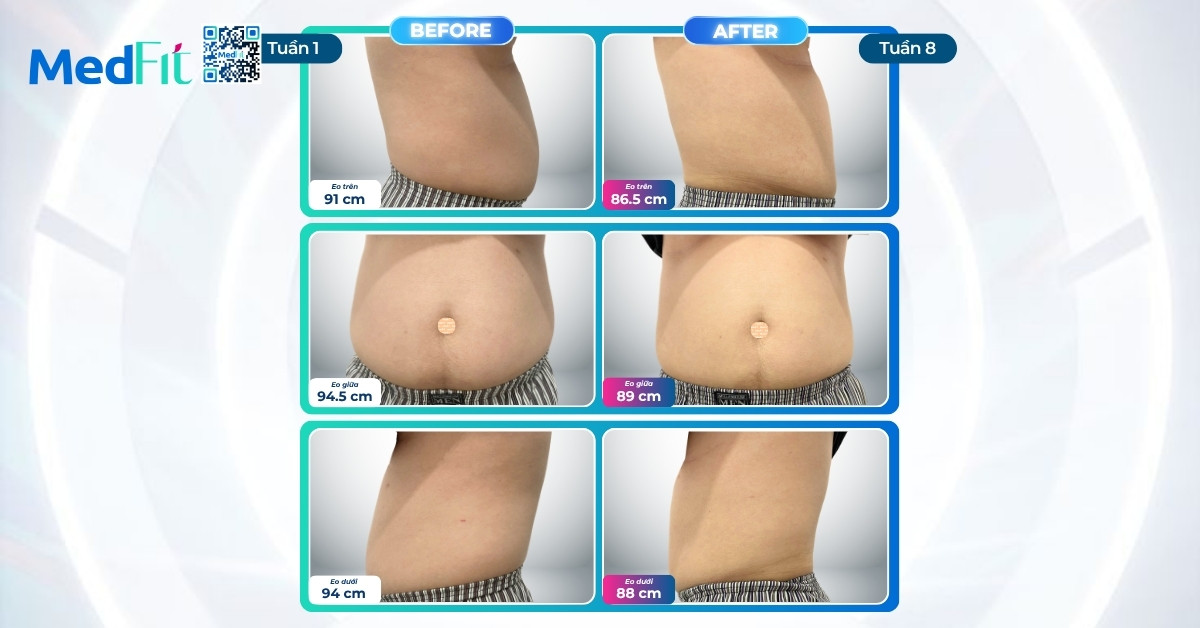 Hành trình giảm cân ngoạn mục của khách hàng trong 8 tuần, giảm 10,5kg và 16cm vòng eo tại MedFit 5 Hành trình giảm cân ngoạn mục của khách hàng trong 8 tuần, giảm 10,5kg và 16cm vòng eo tại MedFit 4