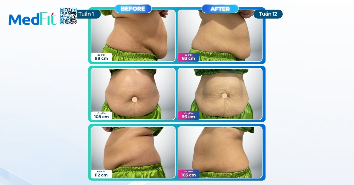Khách hàng ngưỡng 40+ lấy lại vóc dáng, giảm 8,3kg và 39cm vòng eo sau 12 tuần 7 Khách hàng ngưỡng 40+ lấy lại vóc dáng, giảm 8,3kg và 39cm vòng eo sau 12 tuần 6