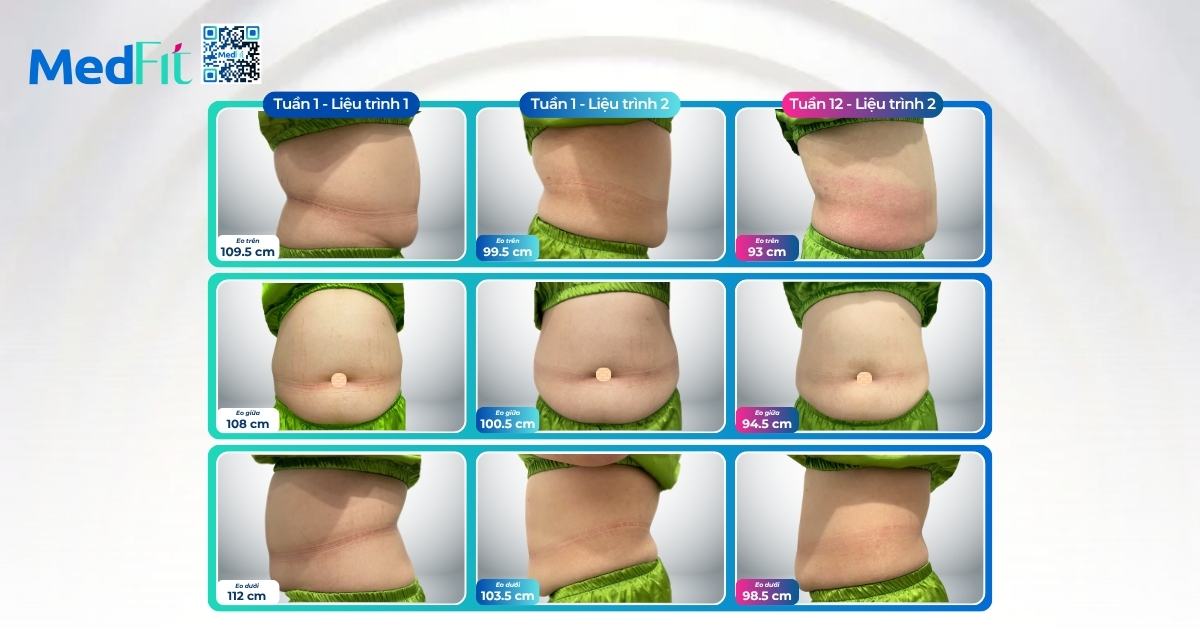 Giảm 8,3kg ở liệu trình đầu, khách hàng tiếp tục giảm gần 8kg và 17,5cm vòng eo sau liệu trình 2 tại MedFit 16 Giảm 8,3kg ở liệu trình đầu, khách hàng tiếp tục giảm gần 8kg và 17,5cm vòng eo sau liệu trình 2 tại MedFit 15
