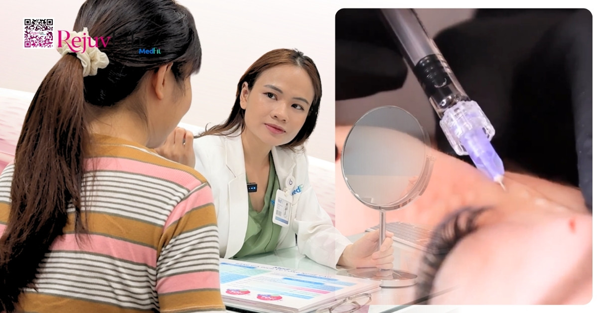 Tiêm meso loại nào tốt? Bí quyết chọn đúng sản phẩm để không lãng phí tiền bạc 42 Tiêm meso loại nào tốt? Bí quyết chọn đúng sản phẩm để không lãng phí tiền bạc 41