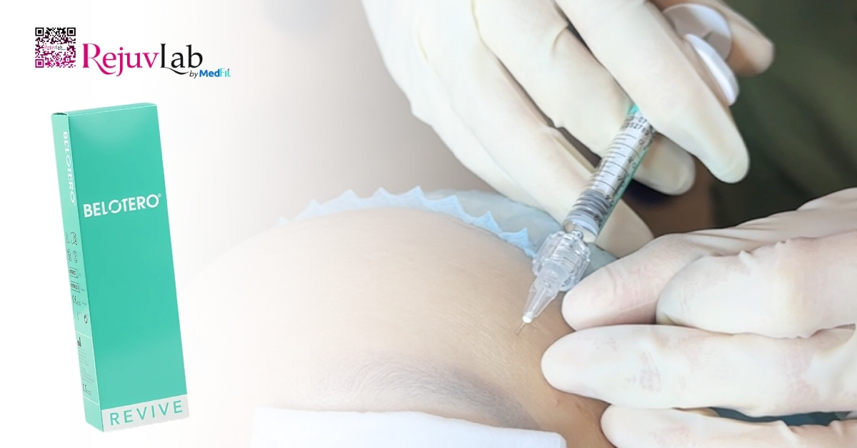 Tiêm meso loại nào tốt? Bí quyết chọn đúng sản phẩm để không lãng phí tiền bạc 28 Tiêm meso loại nào tốt? Bí quyết chọn đúng sản phẩm để không lãng phí tiền bạc 27