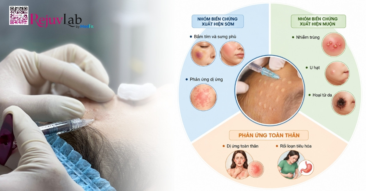 Cách nhận biết sớm biến chứng tiêm meso để tránh tổn thương da vĩnh viễn 6 Cách nhận biết sớm biến chứng tiêm meso để tránh tổn thương da vĩnh viễn 5
