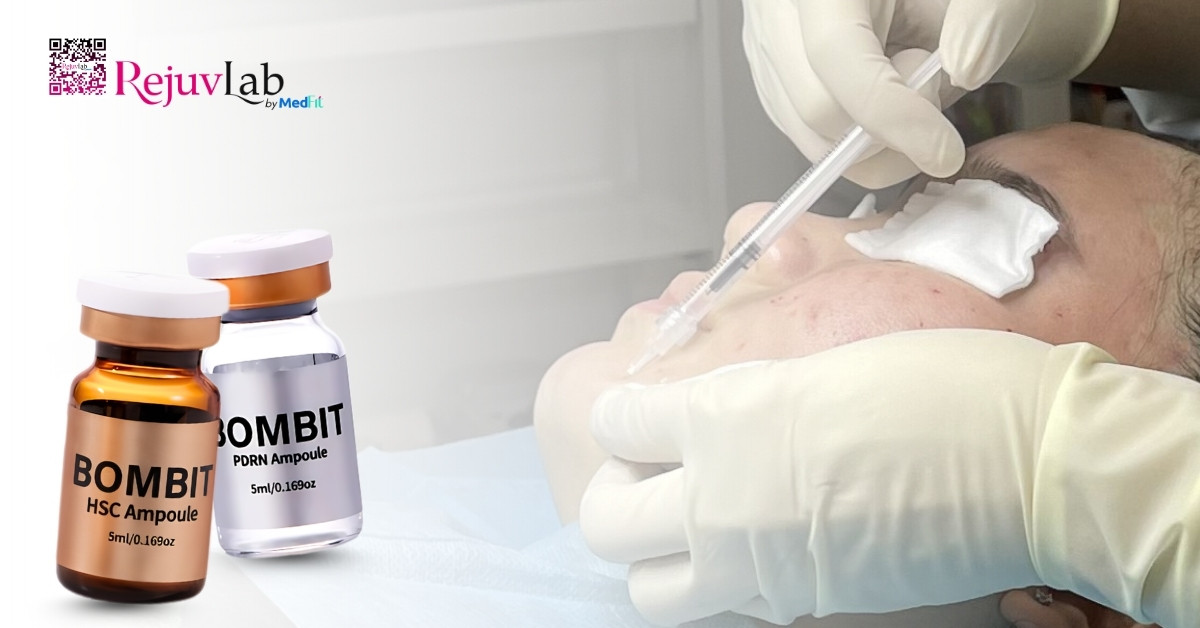 Tiêm meso loại nào tốt? Bí quyết chọn đúng sản phẩm để không lãng phí tiền bạc 38 Tiêm meso loại nào tốt? Bí quyết chọn đúng sản phẩm để không lãng phí tiền bạc 37