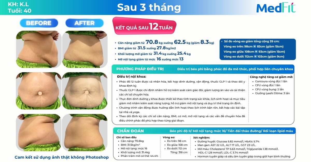 Khách hàng ngưỡng 40+ lấy lại vóc dáng, giảm 8,3kg và 39cm vòng eo sau 12 tuần 9 Khách hàng ngưỡng 40+ lấy lại vóc dáng, giảm 8,3kg và 39cm vòng eo sau 12 tuần 8
