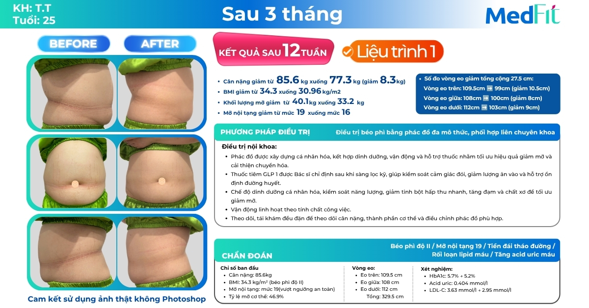Giảm 8,3kg ở liệu trình đầu, khách hàng tiếp tục giảm gần 8kg và 17,5cm vòng eo sau liệu trình 2 tại MedFit 10 Giảm 8,3kg ở liệu trình đầu, khách hàng tiếp tục giảm gần 8kg và 17,5cm vòng eo sau liệu trình 2 tại MedFit 9