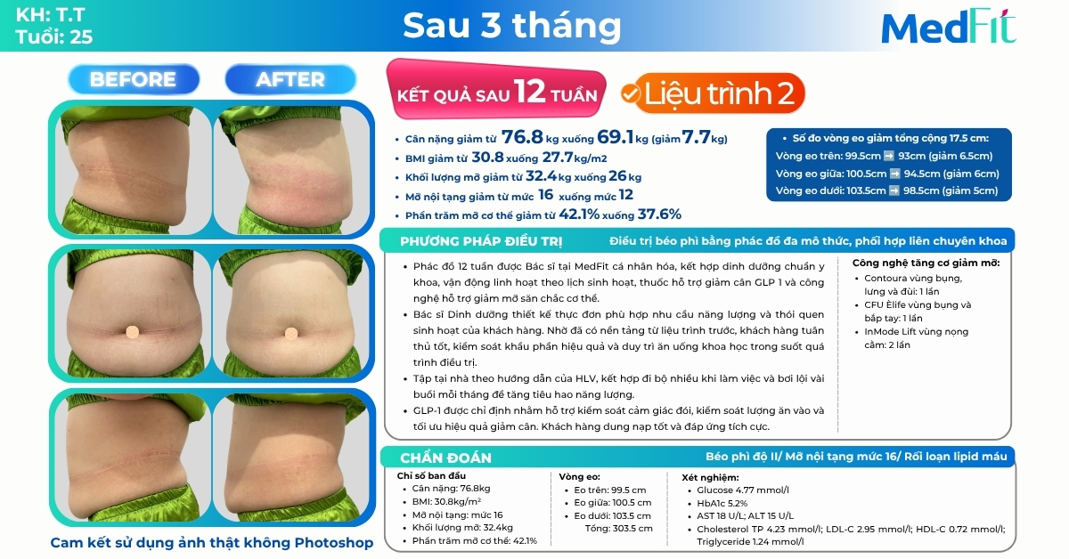 Giảm 8,3kg ở liệu trình đầu, khách hàng tiếp tục giảm gần 8kg và 17,5cm vòng eo sau liệu trình 2 tại MedFit 20 Giảm 8,3kg ở liệu trình đầu, khách hàng tiếp tục giảm gần 8kg và 17,5cm vòng eo sau liệu trình 2 tại MedFit 19