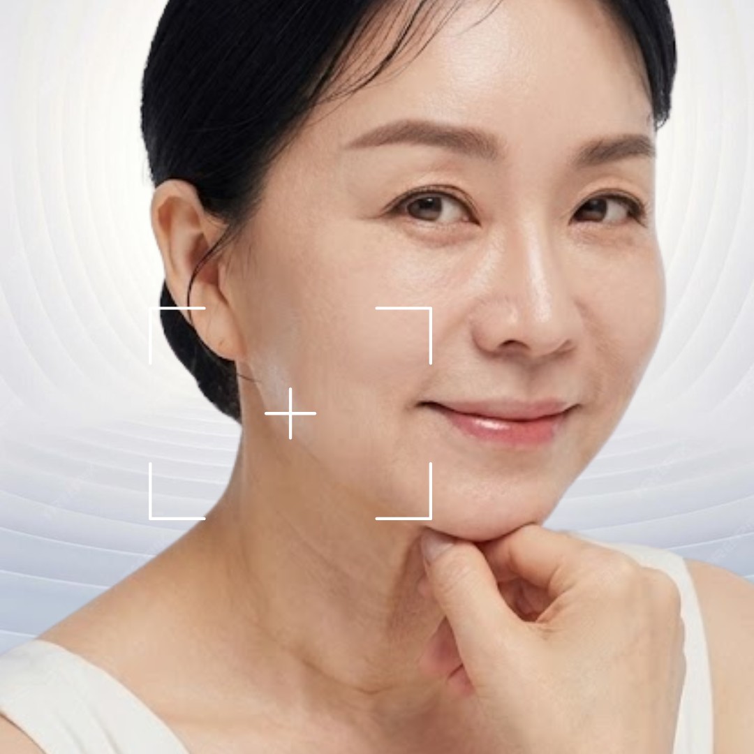 Cải thiện đường viền hàm