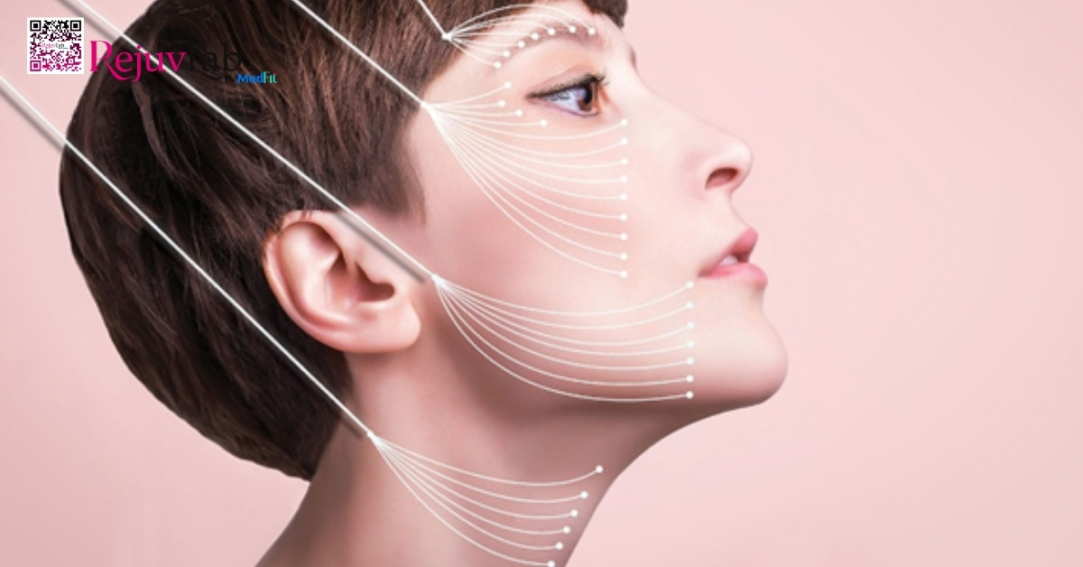 Phụ nữ dưới 40 tuổi có nên phẫu thuật căng da mặt sớm không? 2 Phụ nữ dưới 40 tuổi có nên phẫu thuật căng da mặt sớm không? 1