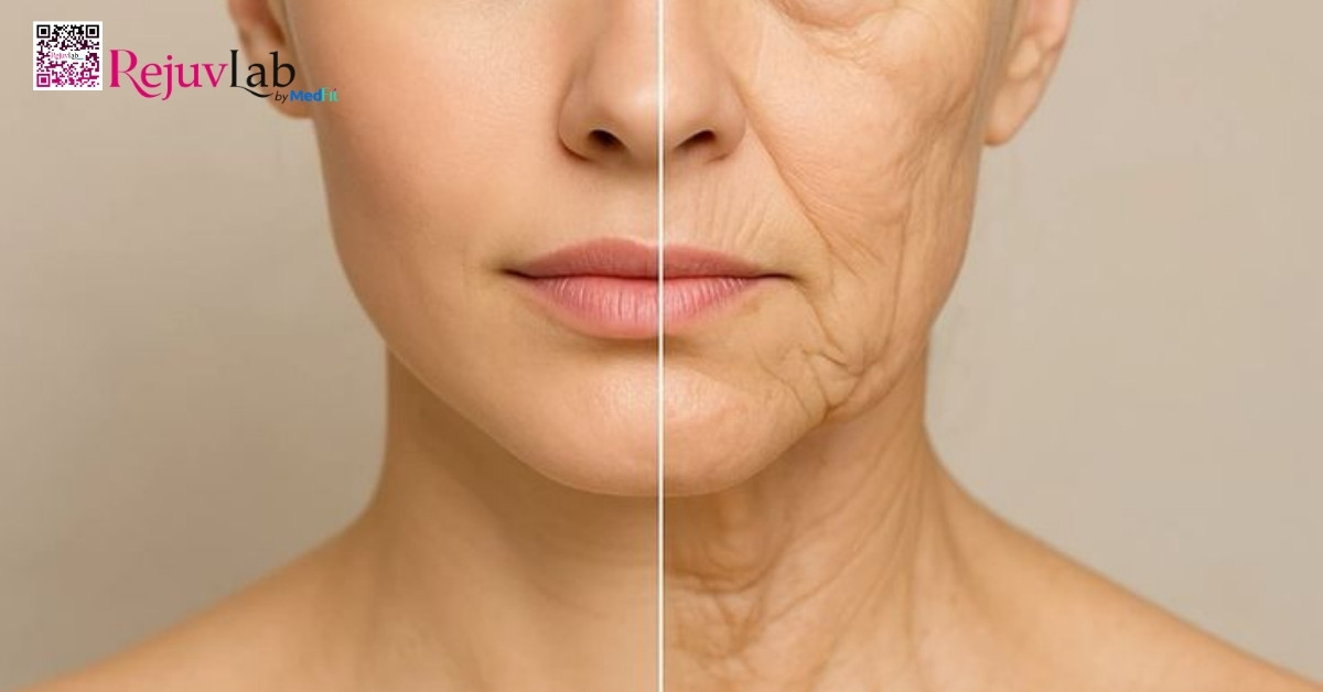 Phụ nữ dưới 40 tuổi có nên phẫu thuật căng da mặt sớm không? 12 Phụ nữ dưới 40 tuổi có nên phẫu thuật căng da mặt sớm không? 11