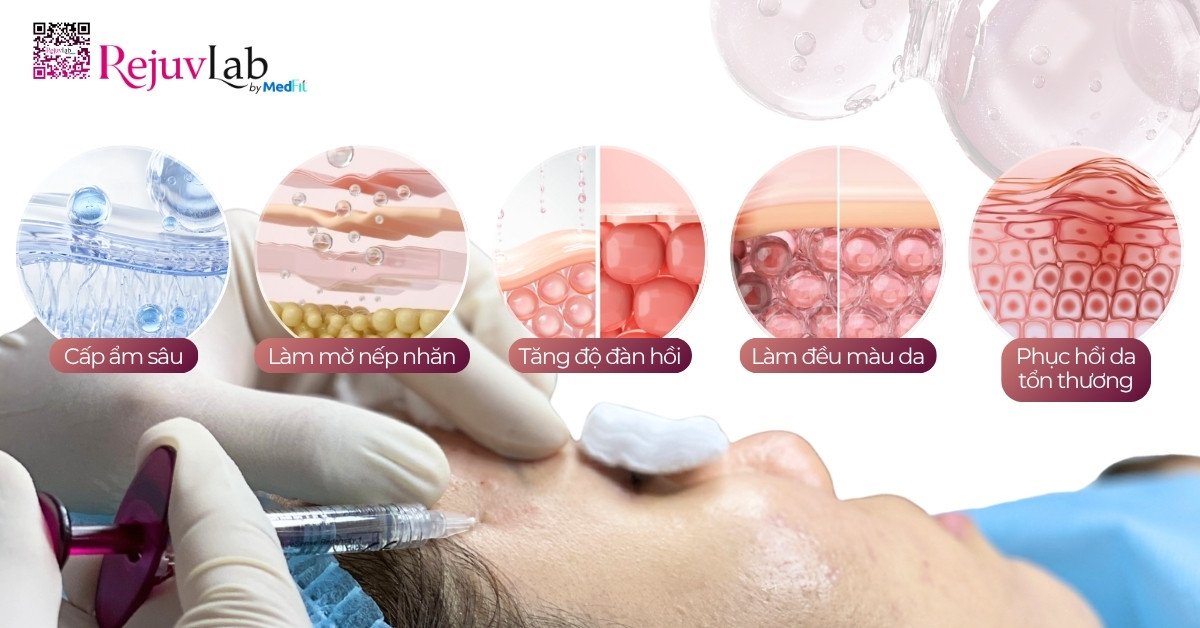 Tiêm meso có đau không? Review chân thực và những rủi ro cần lưu ý 2 Tiêm meso có đau không? Review chân thực và những rủi ro cần lưu ý 1
