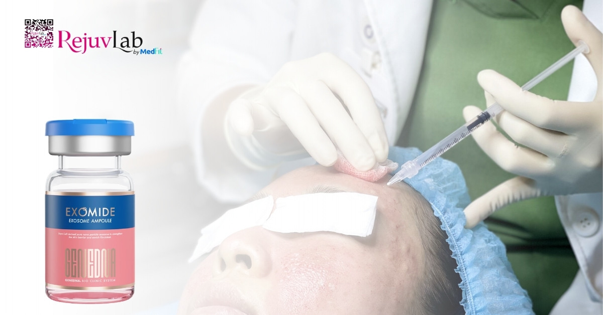 Tiêm meso loại nào tốt? Bí quyết chọn đúng sản phẩm để không lãng phí tiền bạc 40 Tiêm meso loại nào tốt? Bí quyết chọn đúng sản phẩm để không lãng phí tiền bạc 39