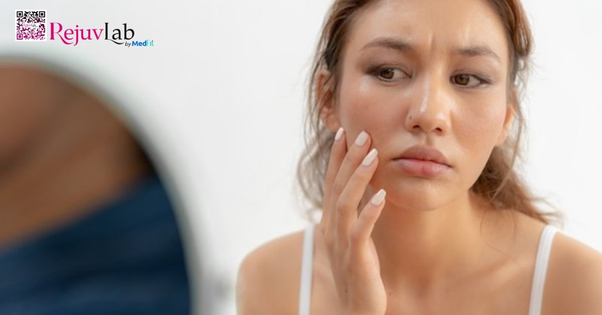 Tiêm meso vùng mắt: Giải pháp cải thiện quầng thâm và nếp nhăn li ti hiệu quả 8 Tiêm meso vùng mắt: Giải pháp cải thiện quầng thâm và nếp nhăn li ti hiệu quả 7