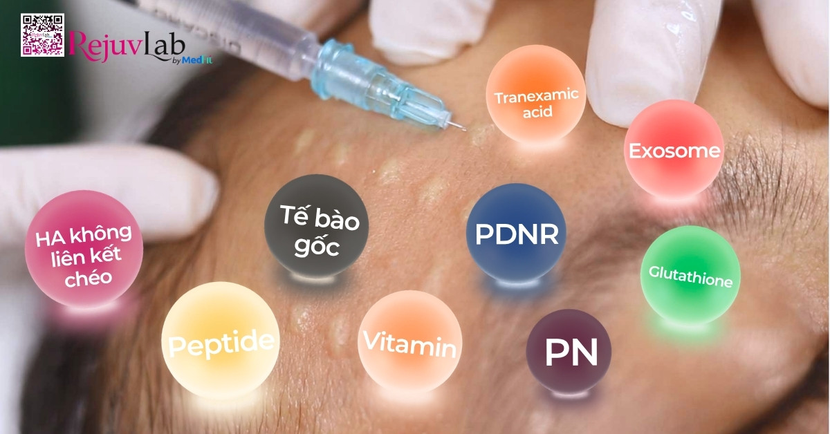 Profhilo và mesotherapy: Đâu là lựa chọn hoàn hảo cho làn da của bạn? 2 Profhilo và mesotherapy: Đâu là lựa chọn hoàn hảo cho làn da của bạn? 1