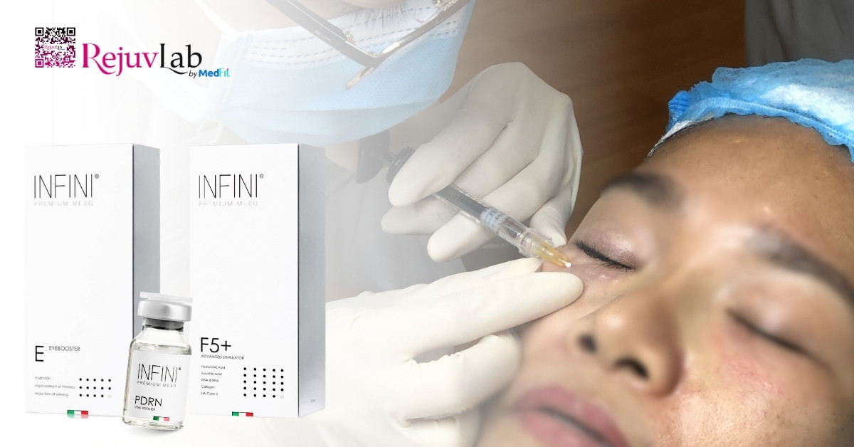 Tiêm meso loại nào tốt? Bí quyết chọn đúng sản phẩm để không lãng phí tiền bạc 32 Tiêm meso loại nào tốt? Bí quyết chọn đúng sản phẩm để không lãng phí tiền bạc 31