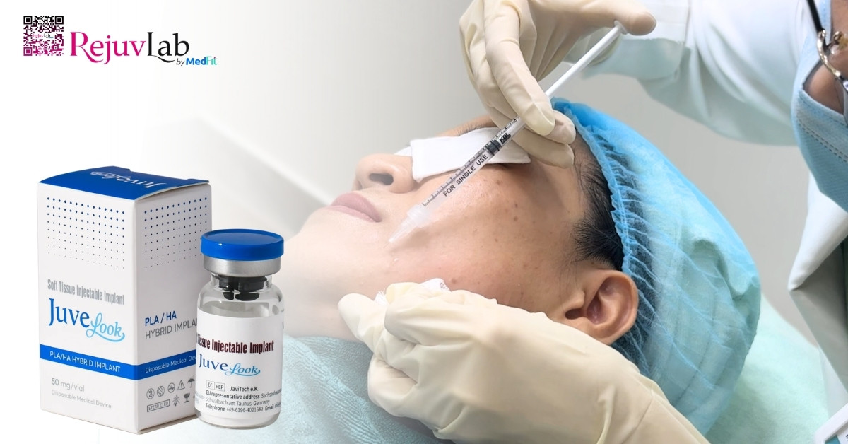 Tiêm meso loại nào tốt? Bí quyết chọn đúng sản phẩm để không lãng phí tiền bạc 18 Tiêm meso loại nào tốt? Bí quyết chọn đúng sản phẩm để không lãng phí tiền bạc 17