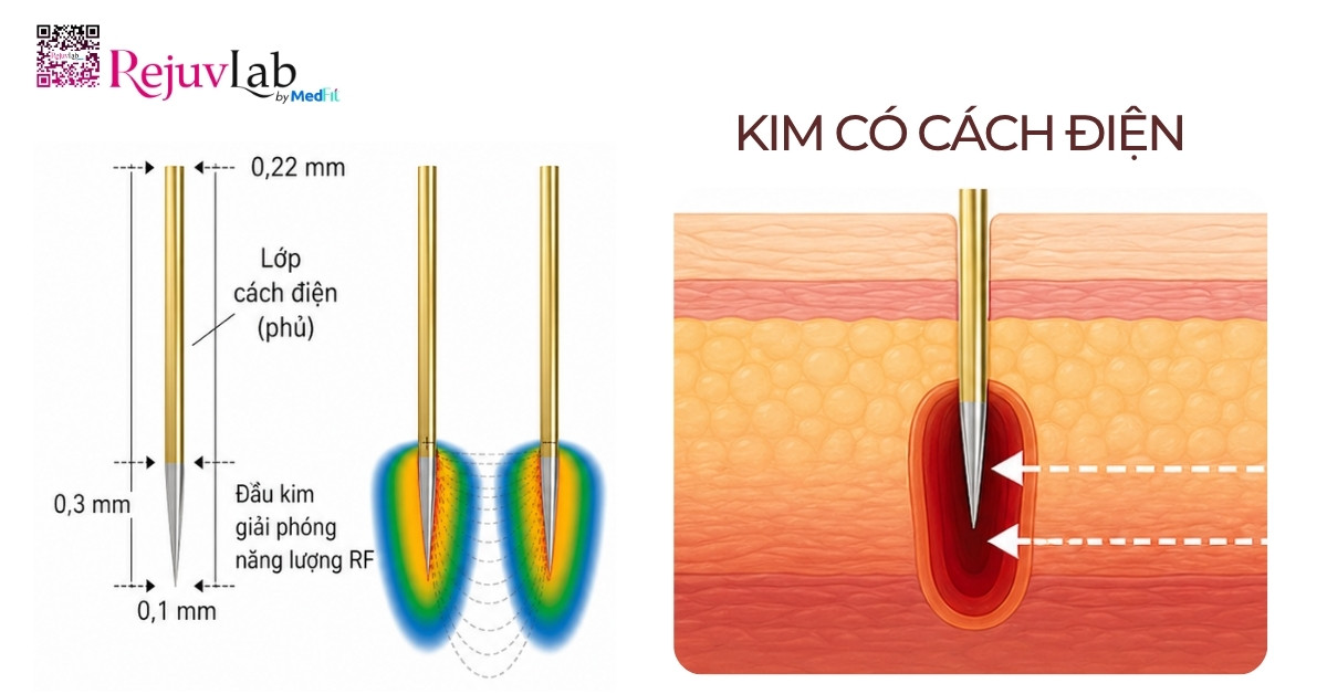 RF vi kim cách điện và không cách điện: Khác nhau thế nào, nên chọn loại nào? 4 RF vi kim cách điện và không cách điện: Khác nhau thế nào, nên chọn loại nào? 3