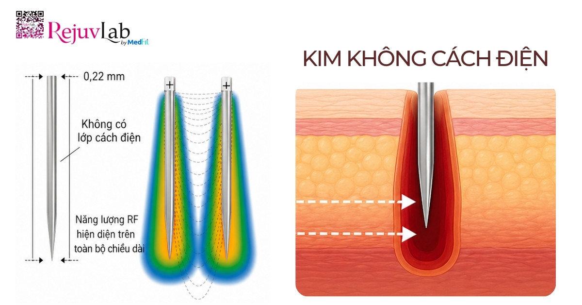 RF vi kim cách điện và không cách điện: Khác nhau thế nào, nên chọn loại nào? 7 RF vi kim cách điện và không cách điện: Khác nhau thế nào, nên chọn loại nào? 6
