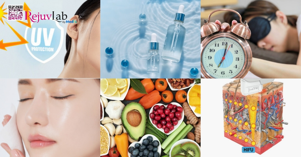 Tiêm meso vùng mắt: Giải pháp cải thiện quầng thâm và nếp nhăn li ti hiệu quả 12 Tiêm meso vùng mắt: Giải pháp cải thiện quầng thâm và nếp nhăn li ti hiệu quả 11