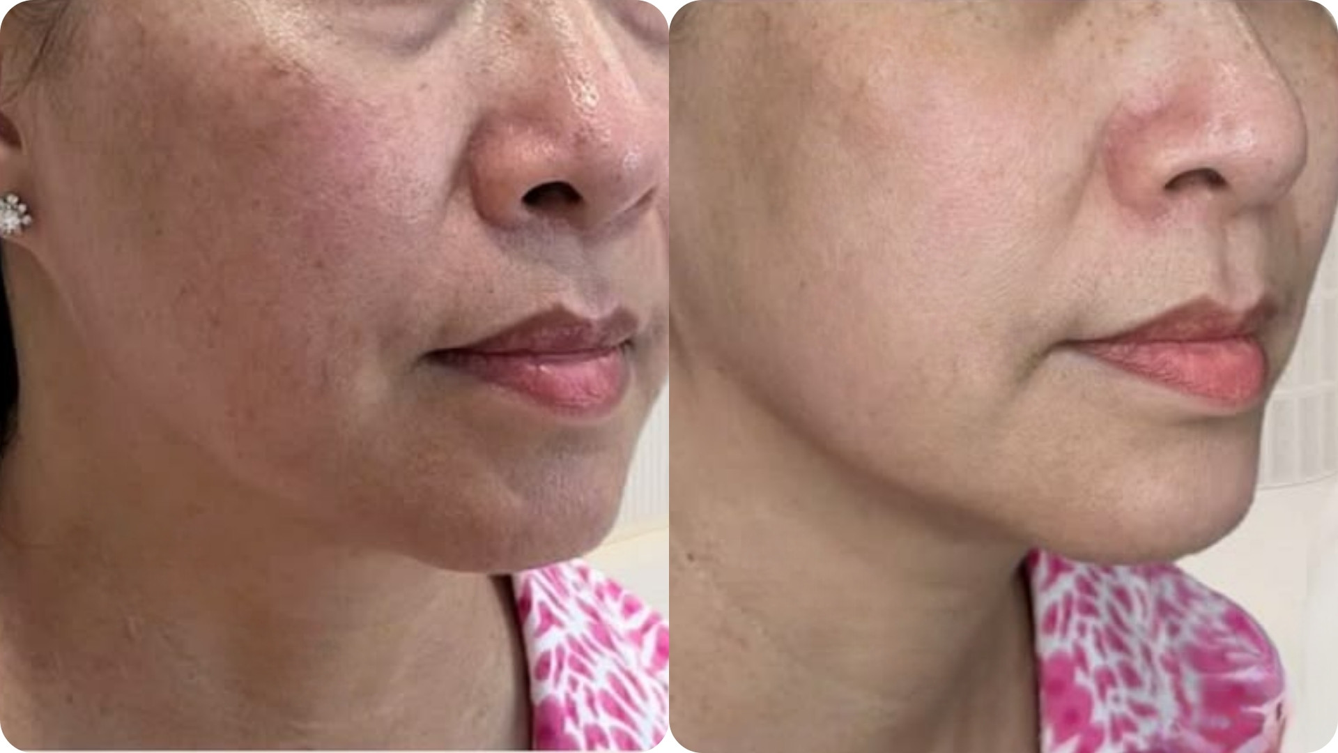 Mang lại làn da đàn hồi, căng mịn và tươi sáng
