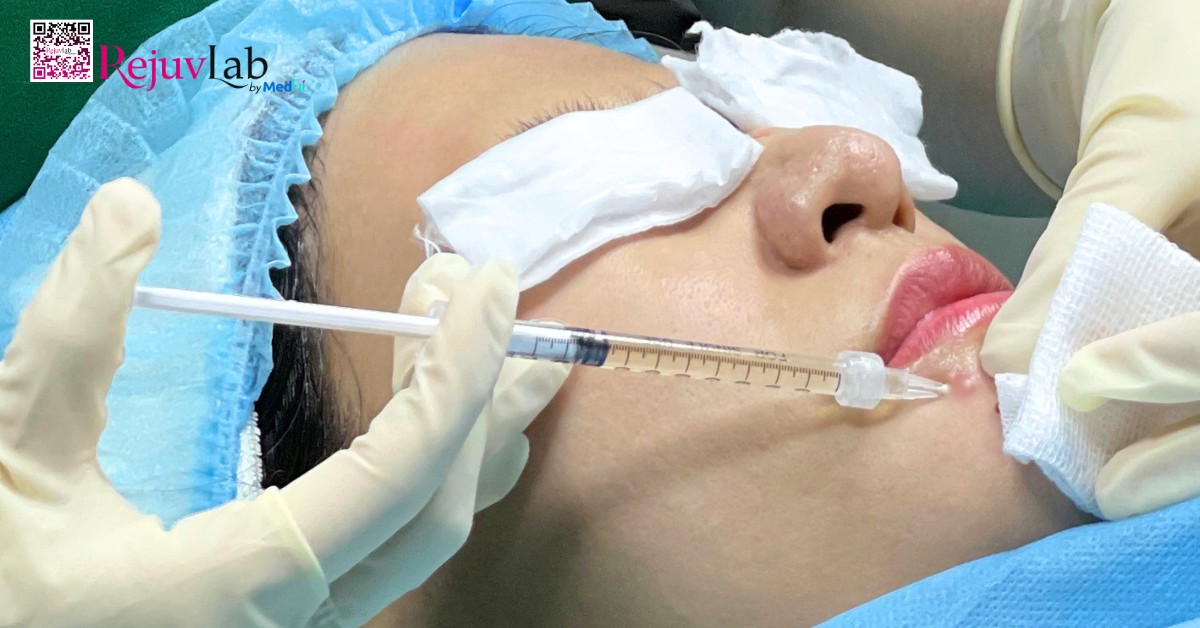 7 loại meso phổ biến và bí quyết lựa chọn hoạt chất phù hợp cho làn da 15 7 loại meso phổ biến và bí quyết lựa chọn hoạt chất phù hợp cho làn da 14