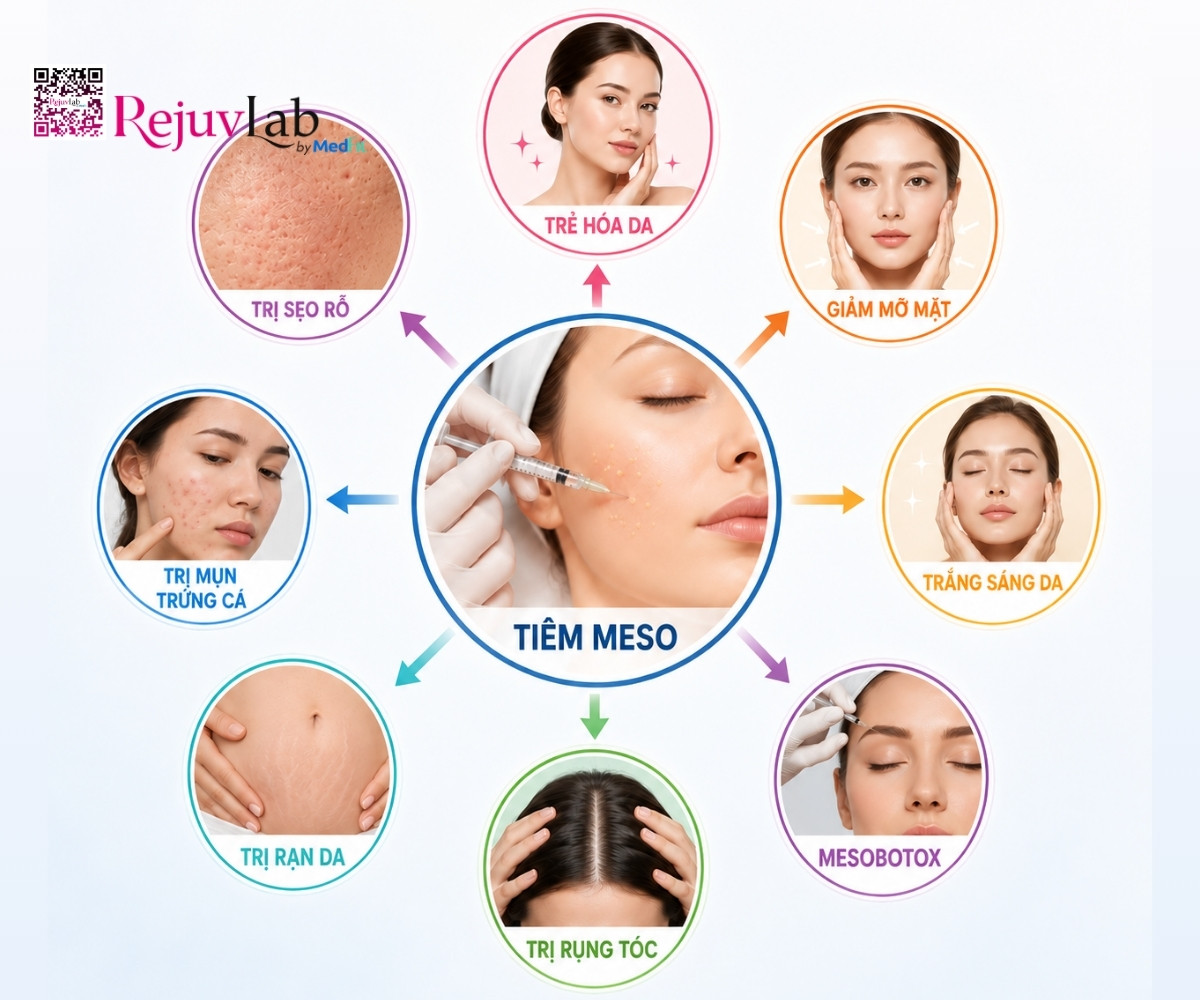 Profhilo và mesotherapy: Đâu là lựa chọn hoàn hảo cho làn da của bạn? 4 Profhilo và mesotherapy: Đâu là lựa chọn hoàn hảo cho làn da của bạn? 3