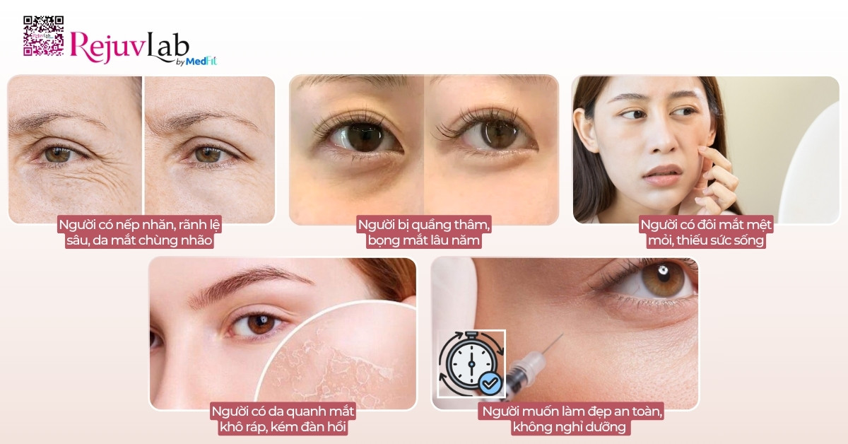 Tiêm meso trị thâm mắt giá bao nhiêu và hiệu quả thực tế thế nào? 10 Tiêm meso trị thâm mắt giá bao nhiêu và hiệu quả thực tế thế nào? 9