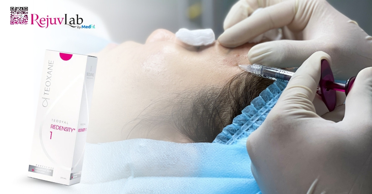 Tiêm meso loại nào tốt? Bí quyết chọn đúng sản phẩm để không lãng phí tiền bạc 24 Tiêm meso loại nào tốt? Bí quyết chọn đúng sản phẩm để không lãng phí tiền bạc 23