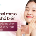 7 loại meso phổ biến và bí quyết lựa chọn hoạt chất phù hợp cho làn da