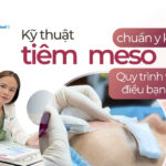 Kỹ thuật tiêm meso chuẩn y khoa: Quy trình và những điều bạn cần biết