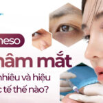 Tiêm meso trị thâm mắt giá bao nhiêu và hiệu quả thực tế thế nào?