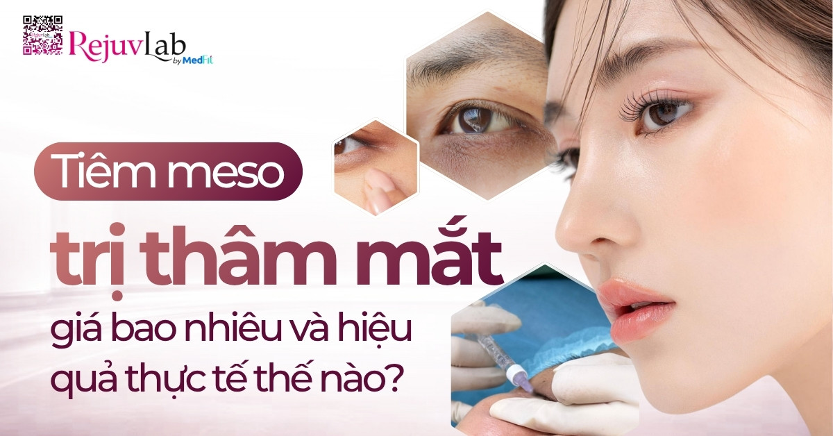 Thumb Tiêm meso trị thâm mắt