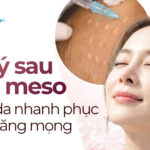 Lưu ý sau khi tiêm meso để làn da nhanh phục hồi và căng mọng