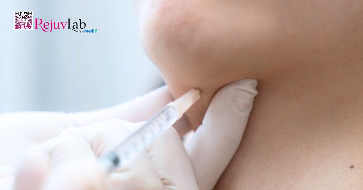 Kỹ thuật tiêm meso chuẩn y khoa: Quy trình và những điều bạn cần biết 14 Kỹ thuật tiêm meso chuẩn y khoa: Quy trình và những điều bạn cần biết 13