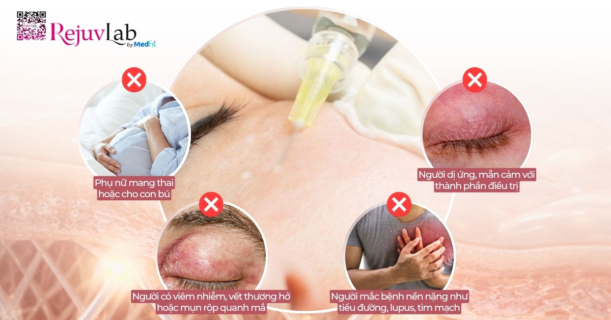 Tiêm meso trị thâm mắt giá bao nhiêu và hiệu quả thực tế thế nào? 12 Tiêm meso trị thâm mắt giá bao nhiêu và hiệu quả thực tế thế nào? 11