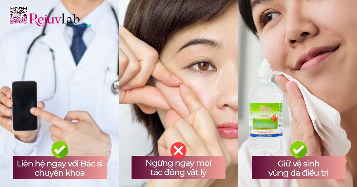 Cách nhận biết sớm biến chứng tiêm meso để tránh tổn thương da vĩnh viễn 11