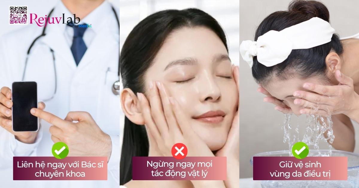 Cách nhận biết sớm biến chứng tiêm meso để tránh tổn thương da vĩnh viễn 12 Cách nhận biết sớm biến chứng tiêm meso để tránh tổn thương da vĩnh viễn 11