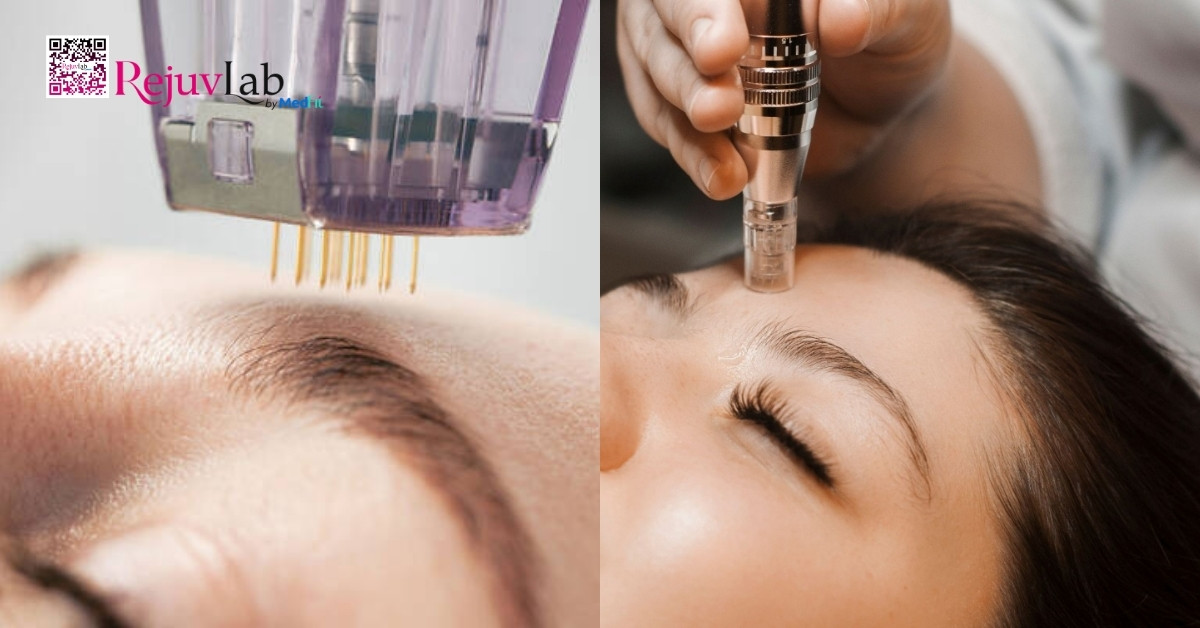 Kỹ thuật tiêm meso chuẩn y khoa: Quy trình và những điều bạn cần biết 10 Kỹ thuật tiêm meso chuẩn y khoa: Quy trình và những điều bạn cần biết 9
