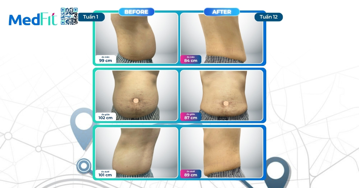 Khám phá hành trình khách hàng nước ngoài giảm gần 16kg và 42cm vòng eo tại MedFit 6 Khám phá hành trình khách hàng nước ngoài giảm gần 16kg và 42cm vòng eo tại MedFit 5