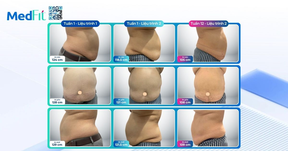 Tuổi tác không cản bước hành trình giảm cân: Khách hàng U70 giảm 8,9kg, tiếp tục giảm thêm 9kg và 39cm vòng eo tại MedFit 13
