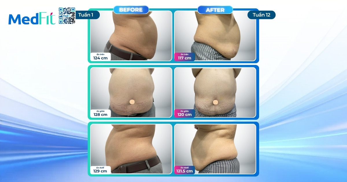 Tuổi tác không cản trở hành trình giảm cân, khách hàng U70 giảm 8,9kg và 22,5cm vòng eo sau 12 tuần 6 Tuổi tác không cản trở hành trình giảm cân, khách hàng U70 giảm 8,9kg và 22,5cm vòng eo sau 12 tuần 5