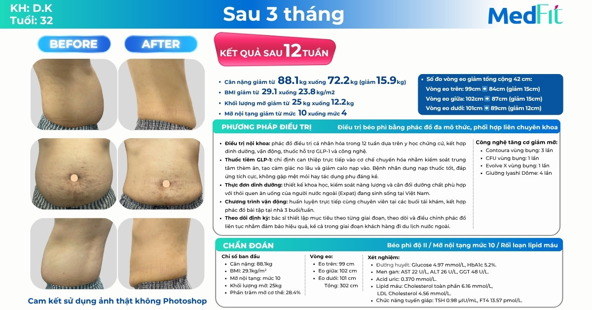 Khám phá hành trình khách hàng nước ngoài giảm gần 16kg và 42cm vòng eo tại MedFit 10 Khám phá hành trình khách hàng nước ngoài giảm gần 16kg và 42cm vòng eo tại MedFit 9