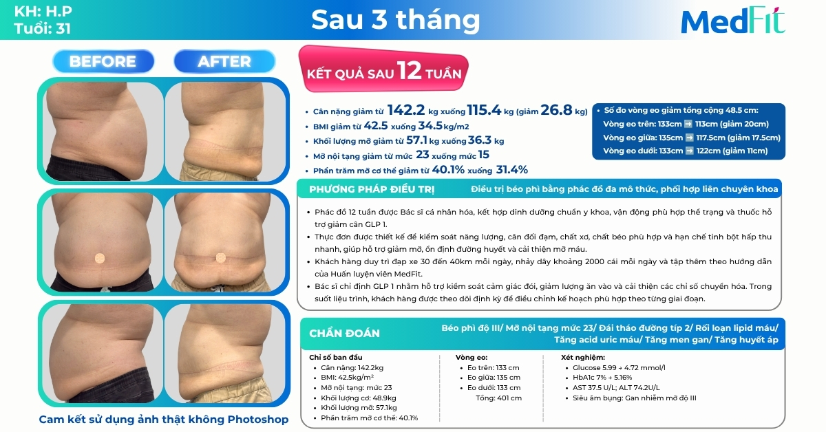 Hành trình giảm ngoạn mục 26,8kg và 48,5cm vòng eo chỉ sau 12 tuần của khách hàng 30+ tại MedFit 9
