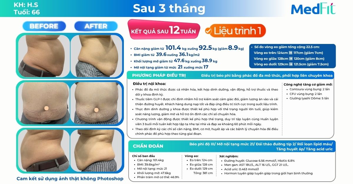 Tuổi tác không cản bước hành trình giảm cân: Khách hàng U70 giảm 8,9kg, tiếp tục giảm thêm 9kg và 39cm vòng eo tại MedFit 9
