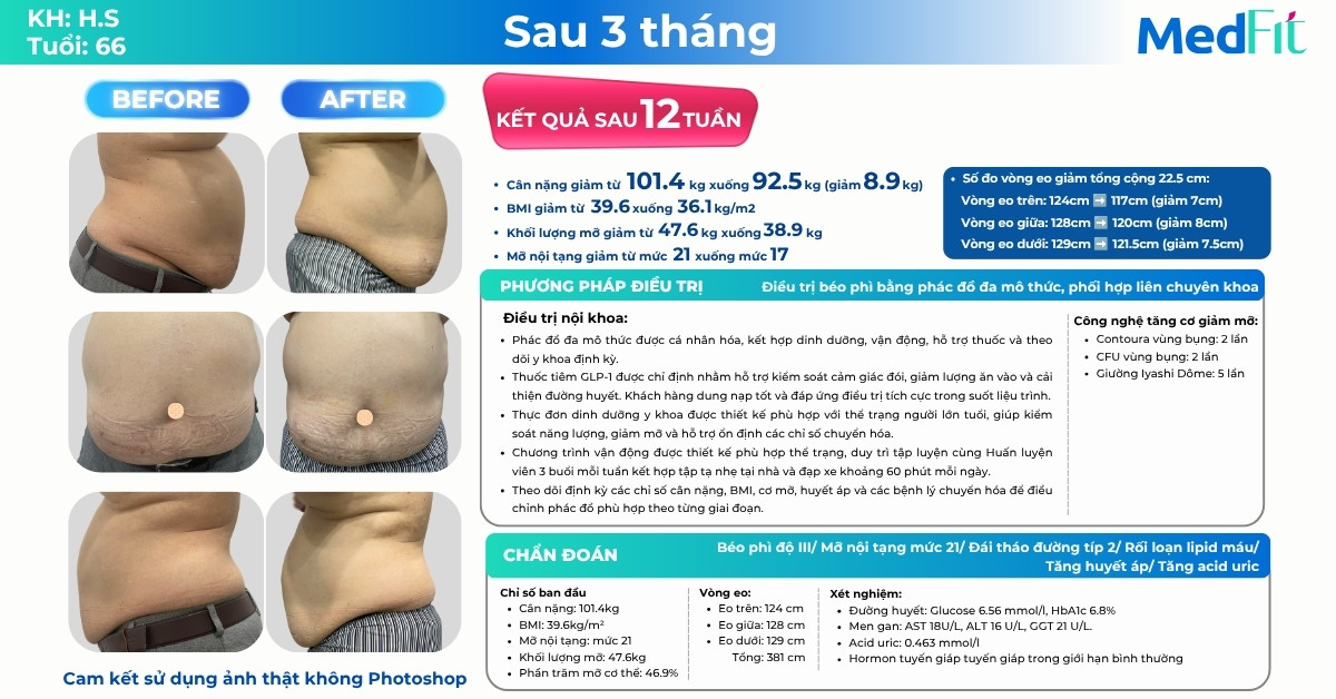 Tuổi tác không cản trở hành trình giảm cân, khách hàng U70 giảm 8,9kg và 22,5cm vòng eo sau 12 tuần 10 Tuổi tác không cản trở hành trình giảm cân, khách hàng U70 giảm 8,9kg và 22,5cm vòng eo sau 12 tuần 9